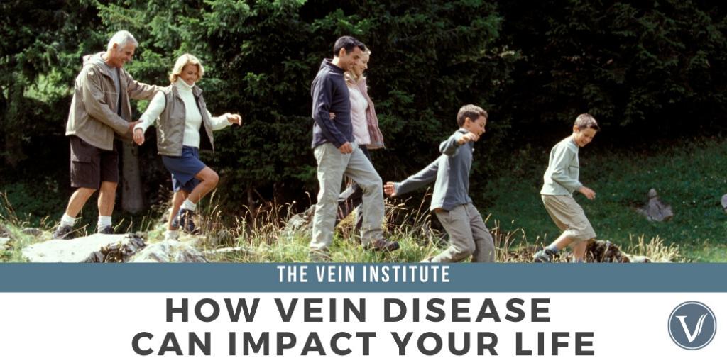 How Vein Disease Can Impact Your Life