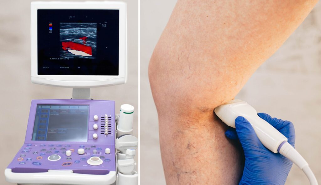 Painless Ultrasound Testing