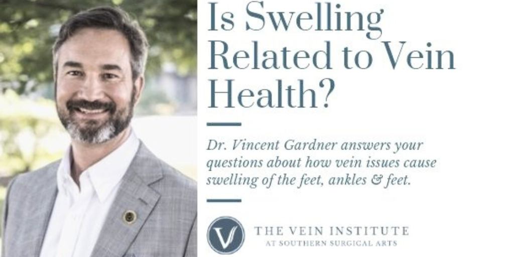 Q&A: Is Swelling Related to Vein Health?