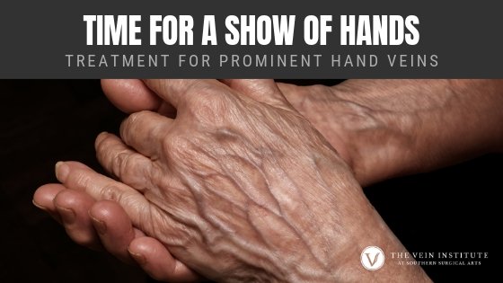 Treatment for Prominent Hand Veins