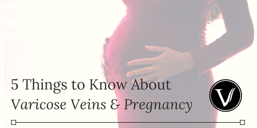 Varicose Veins Pregnancy